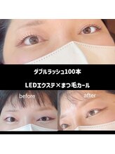 ヴィーナス 船橋駅前店(VENUS)/ダブルラッシュ100本