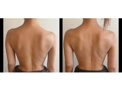 サナ(Sana)の写真