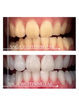 佐賀ホワイトニングラボ/