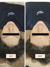 吉川美南ライフ整骨院/40代男性