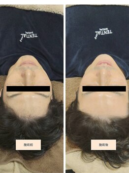 吉川美南ライフ整骨院/40代男性