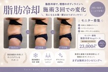 シュシュ(chouchou)