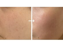 シエール(Shieru)/