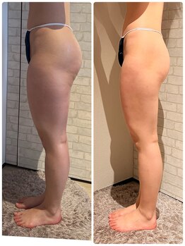 グリーミン 代々木(gleaming)/下半身・脚コースがんばった結果