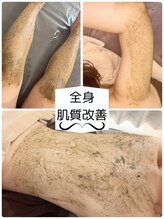 ホワイトアクア 北千住店(WHITE AQUA)/お顔だけではなく全身も肌質改善