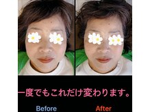 美容矯正サロン レレポノ(LELEPONO)/