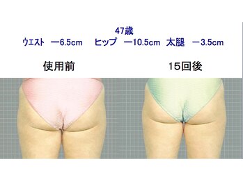 ひろスポーツ整体院/卒業後のサポート