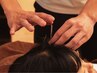 【抜け毛や白髪を解決】鍼で自然治癒/産後のケアにも☆幸髪・美髪鍼灸コース