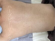 リベル 名古屋(Lebelle:)/ハーブピーリング専門　名古屋　