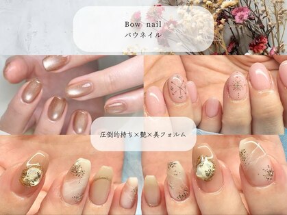 バウネイル(Bow nail)の写真