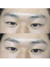 ブロウ(BROW)/【メンズ眉】before after