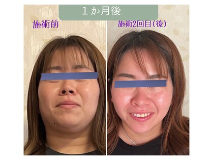 エンズ ハッピーボンズ(Anne’s happyBones)の写真