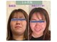 エンズ ハッピーボンズ(Anne’s happyBones)の写真