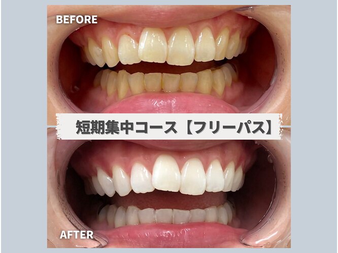 ホワイトニングサロン BE WHITENING 名古屋金山店
