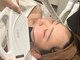 ダリアビューティー(Dahlia Beauty)の写真/目元の頑固なしわも速攻ケア◆BBL光照射で内側からコラーゲン生成を促進し、ハリツヤ溢れるお肌に！