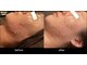 アミュレット(AMULET)の写真