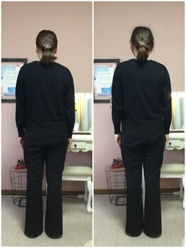 スマイル(smile)/before after 