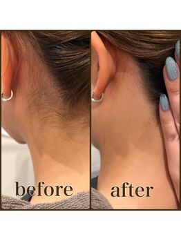 ファビー(Fabby)/うなじシェービング