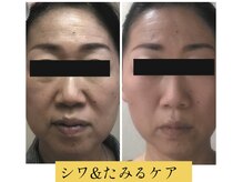 ビューティースパ/娘さんに褒められる小顔♪