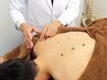 Comprehensive High Quality Japanese Acupuncture (60 min)  ¥15,000