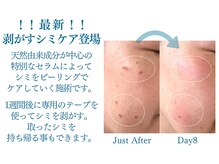 【！最新！】剥がすシミケア★