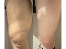 アニス/ひざの上のぽにょ