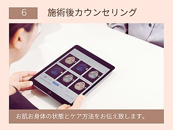 グラツィア(Grazia)/施術後カウンセリング[池袋]