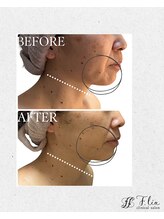 エフリア 大垣(F.lia)/脂肪●引よりもスッキリ★