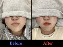 ブルーム(Bloom)の雰囲気（慢性の痛みや凝りだけでなく、小顔など美容にも特化してます）