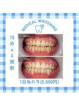 ベルプラス 新大阪(Belle plus)/￥5,500ホワイトニング