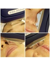 カンパニュラ(campanula)/リピート率98%！人気顔脱毛