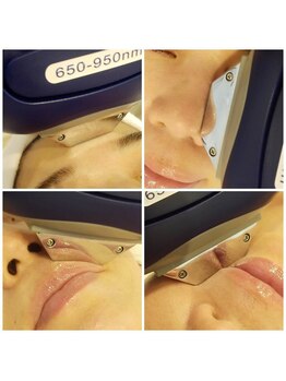 カンパニュラ(campanula)/リピート率98%!人気顔脱毛