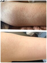 オアジスパ(Oasi Spa)/