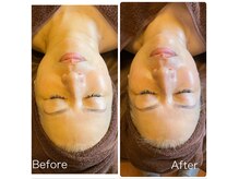 サロン カズリナ(Salon Kazrina)の雰囲気（最速でスッキリツヤツヤの美肌と若々しい見た目を手に入れて）
