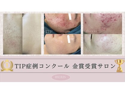 イベリス(Iberis)の写真