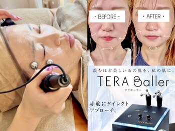 シャインアン(Shine'an)の写真/美顔筋テラボーラーでスッキリ小顔♪ダウンタイムなし！お出かけ前もOKなリフトアップ♪