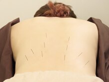 鍼灸院 虹の雰囲気(美容鍼/鍼灸/整体/首/肩こり/小顔/フェイシャル/亀戸水神/亀戸)