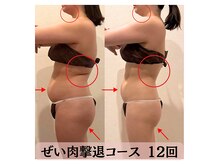 ハナチュチュ 矢場町店(Hanachuchu)/