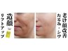【最新】シワ・たるみ改善！造顔リフトアップコース90分　体験5,980円(税込)