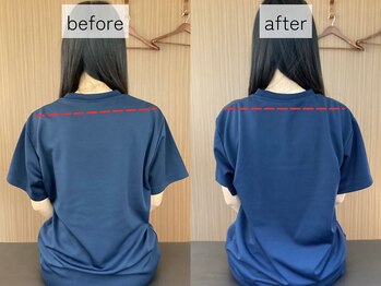 ゼン骨盤整体院(ZEN骨盤整体院)/【20代女性】首肩こり