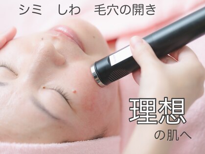 イナファーの写真