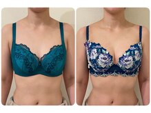 モナンジュ(ramonange)/施術2回目バストとくびれの変化