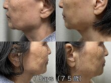 カロン(Kalon)の雰囲気（韓国最新コスメ【インセルダム】の個別体験会をサロンで開催中☆）