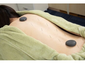 船橋ウィメンズ鍼灸院の写真/はり師・きゅう師・あん摩マッサージ指圧師の３つの医療系国家資格を保有したセラピストが担当します