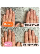 桃の木 吉祥寺店/二枚爪の原因には栄養も関係あり