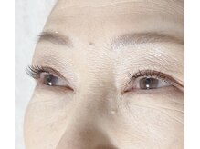 ご希望の方にお顔のパーツ計測し、最適なデザイン提案します