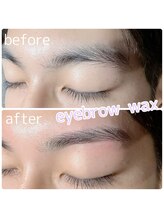 アイデュース acty店(eyeduce)/【メンズ】beforeafter