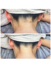 エヌアール(NR)/ladies うなじ