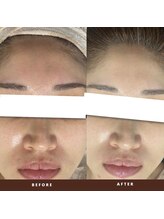 ビーンズ(BEANS)/ララピール　1回でトーンアップ