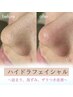 【超お得な夏前限定】毛穴特化☆毛穴洗浄×角栓除去パック 10,000円⇒2,980円